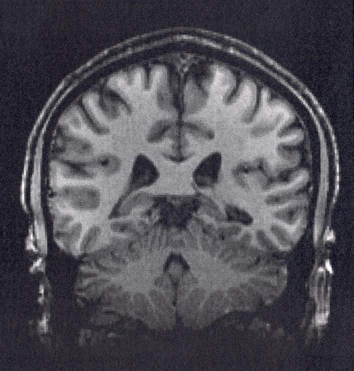 Illustration : Nathanial Burton-Bradford, « fMRI “me” 2 », 20.05.2012, Flickr (licence Creative Commons)